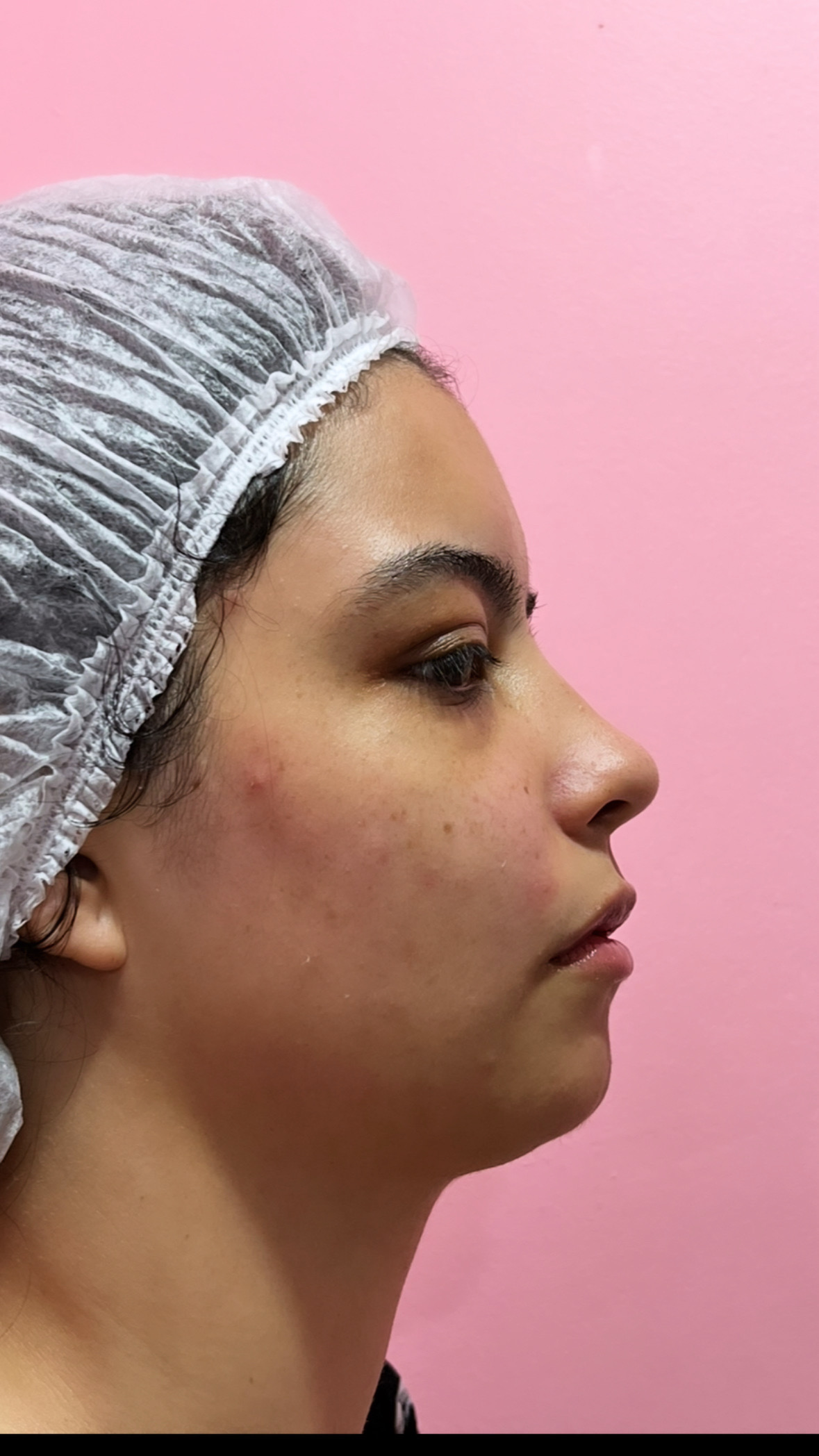 Limpeza de Pele em Perdizes